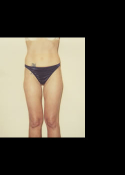 After Image