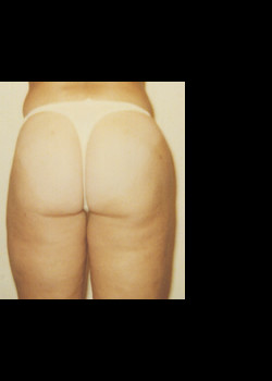 After Image