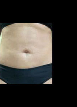 After Image